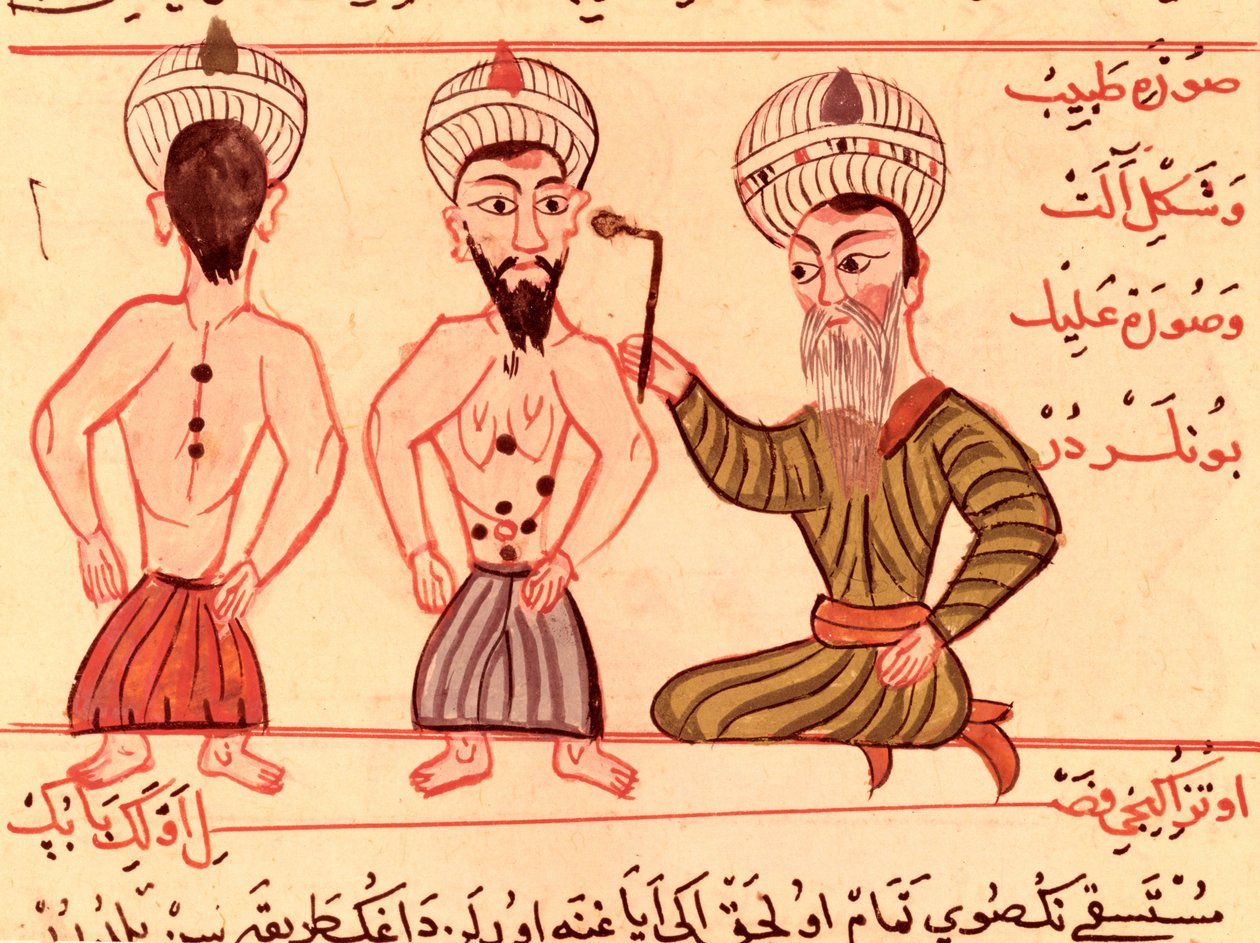 Ms Sup Turc 693 fol.35 ऑपरेशन के लिए गर्भाधान, 1466 द्वारा चराफ एड दीन