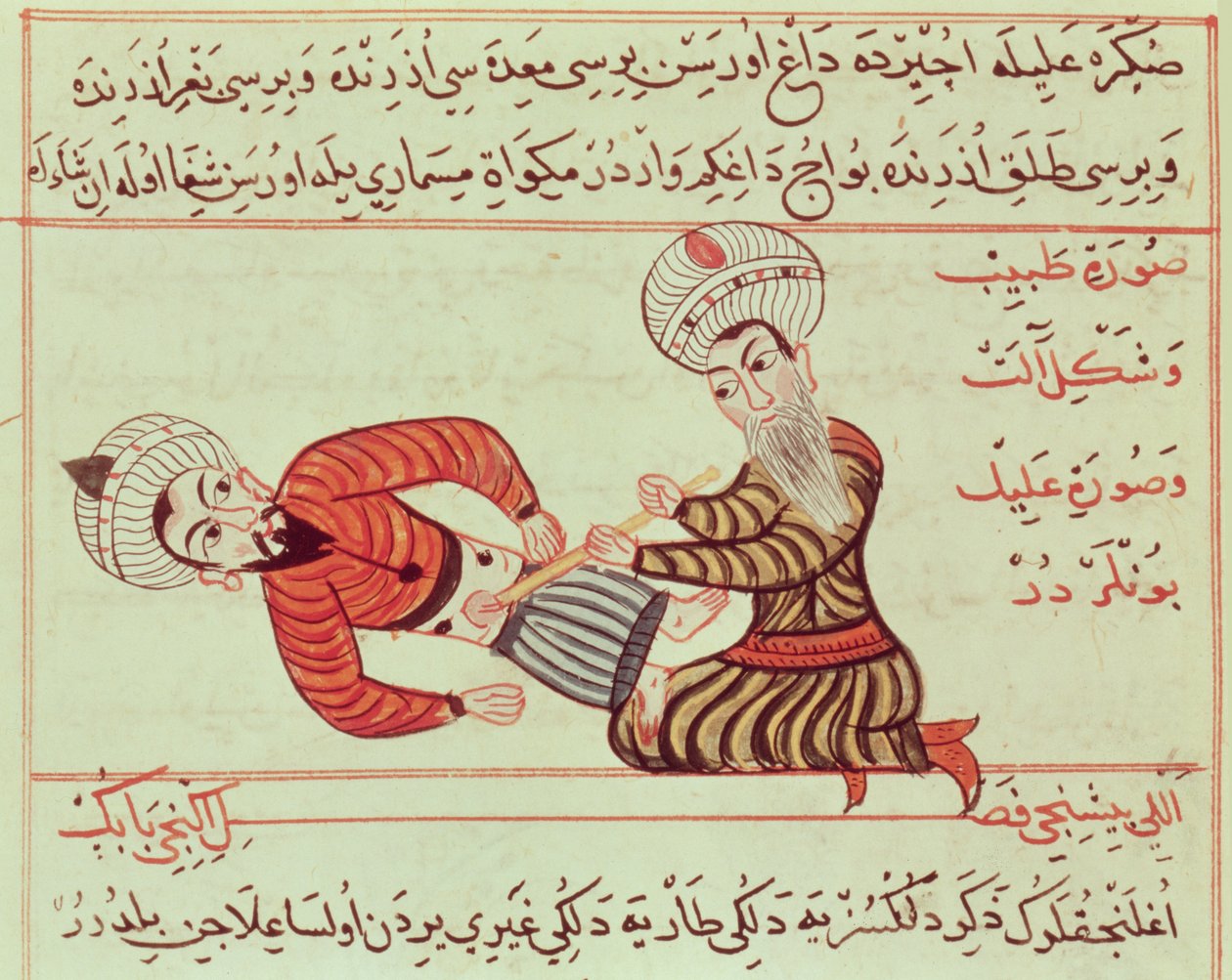 Ms Sup Turc 693 fol.95 बूंदों से पीड़ित रोगी पर एक कैनुला के साथ पेरिटोनियल तरल पदार्थ की आकांक्षा के उदर गुहा की सर्जिकल पंचर, 1466 द्वारा चराफ एड दीन