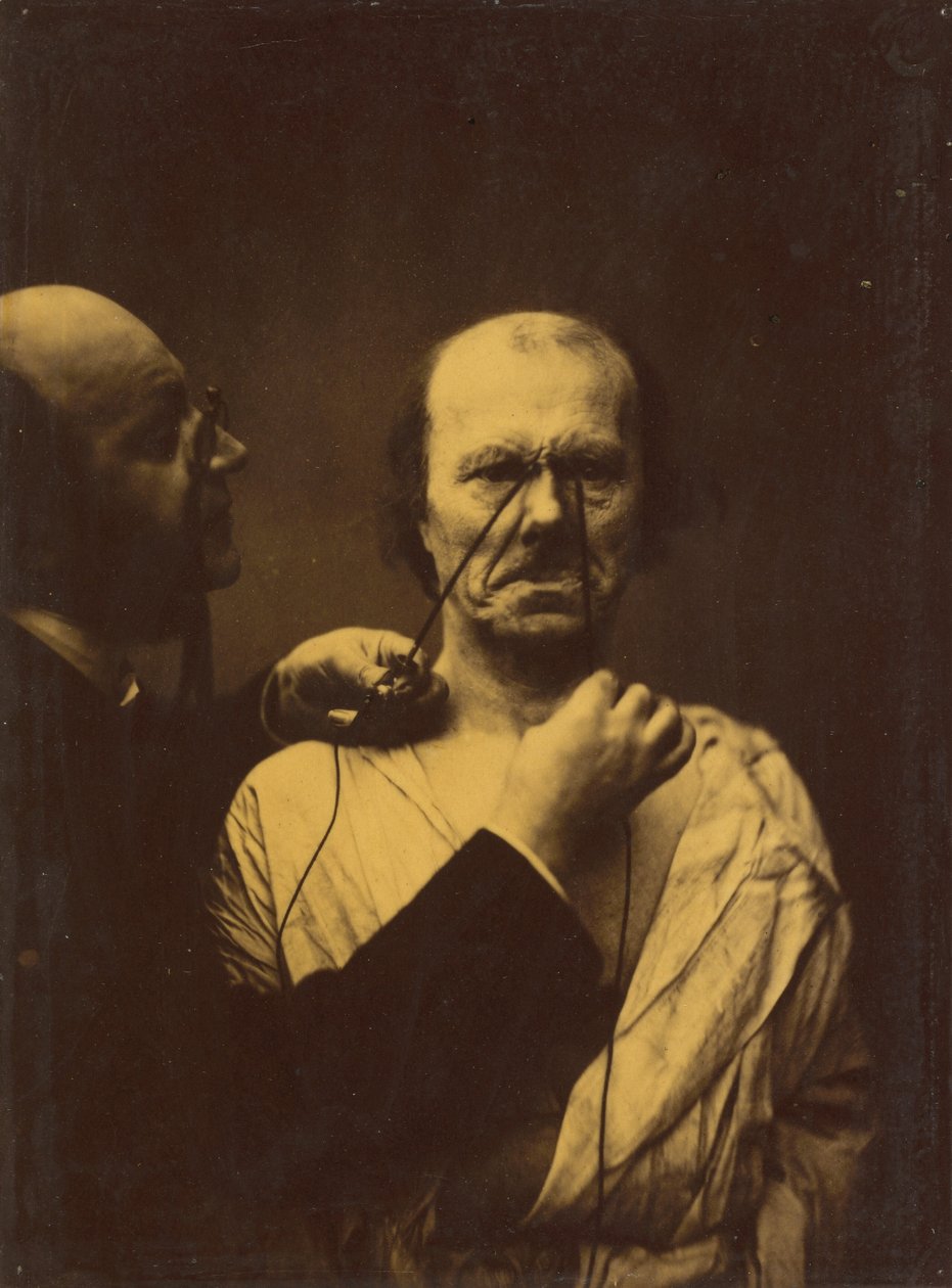 आक्रामकता, दुष्टता, 1854-1856, 1862 छपी। द्वारा डचेन डी बोलोग्ने