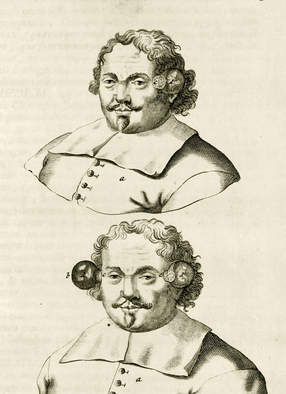 सिंघी, व्यावहारिक अभ्यास से का एक उदाहरण फ्रेडेरिक डेक्कर्स द्वारा, 1694 विधि के इलाज के लिए द्वारा डच स्कूल