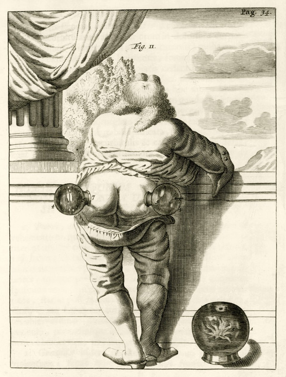 सिंघी, व्यावहारिक अभ्यास से का एक उदाहरण फ्रेडेरिक डेक्कर्स द्वारा, 1694 विधि के इलाज के लिए द्वारा डच स्कूल
