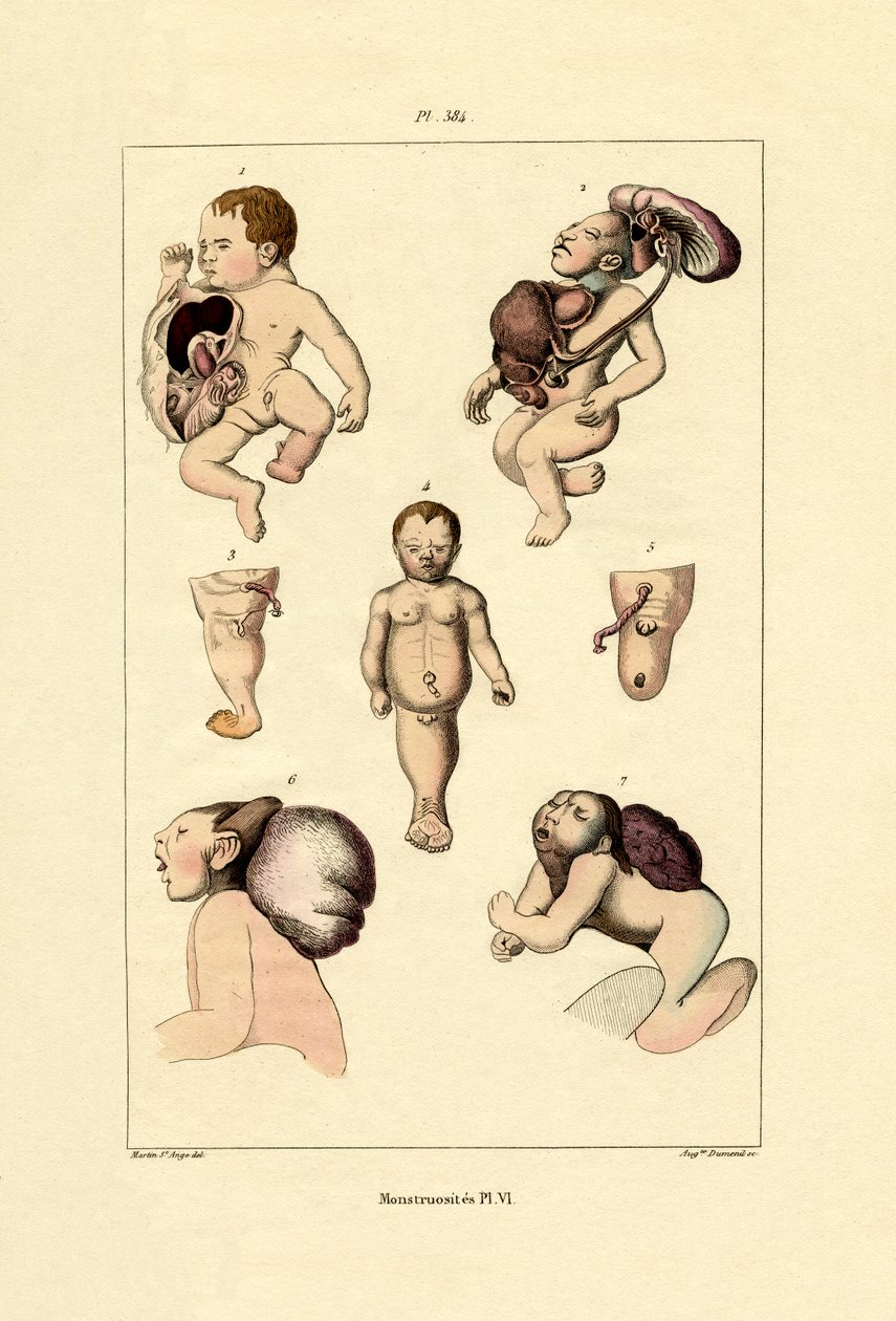 फ्रीक, 1833-39 द्वारा फ्रेंच स्कूल