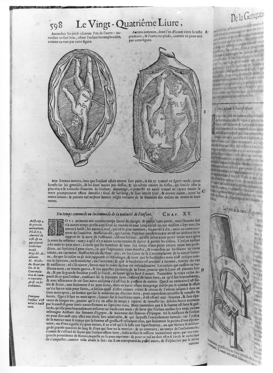 भ्रूण, लिब्रोन, 1641 में प्रकाशित एंब्रोज पारे (1509-90) द्वारा किए गए चित्र द्वारा फ्रेंच स्कूल
