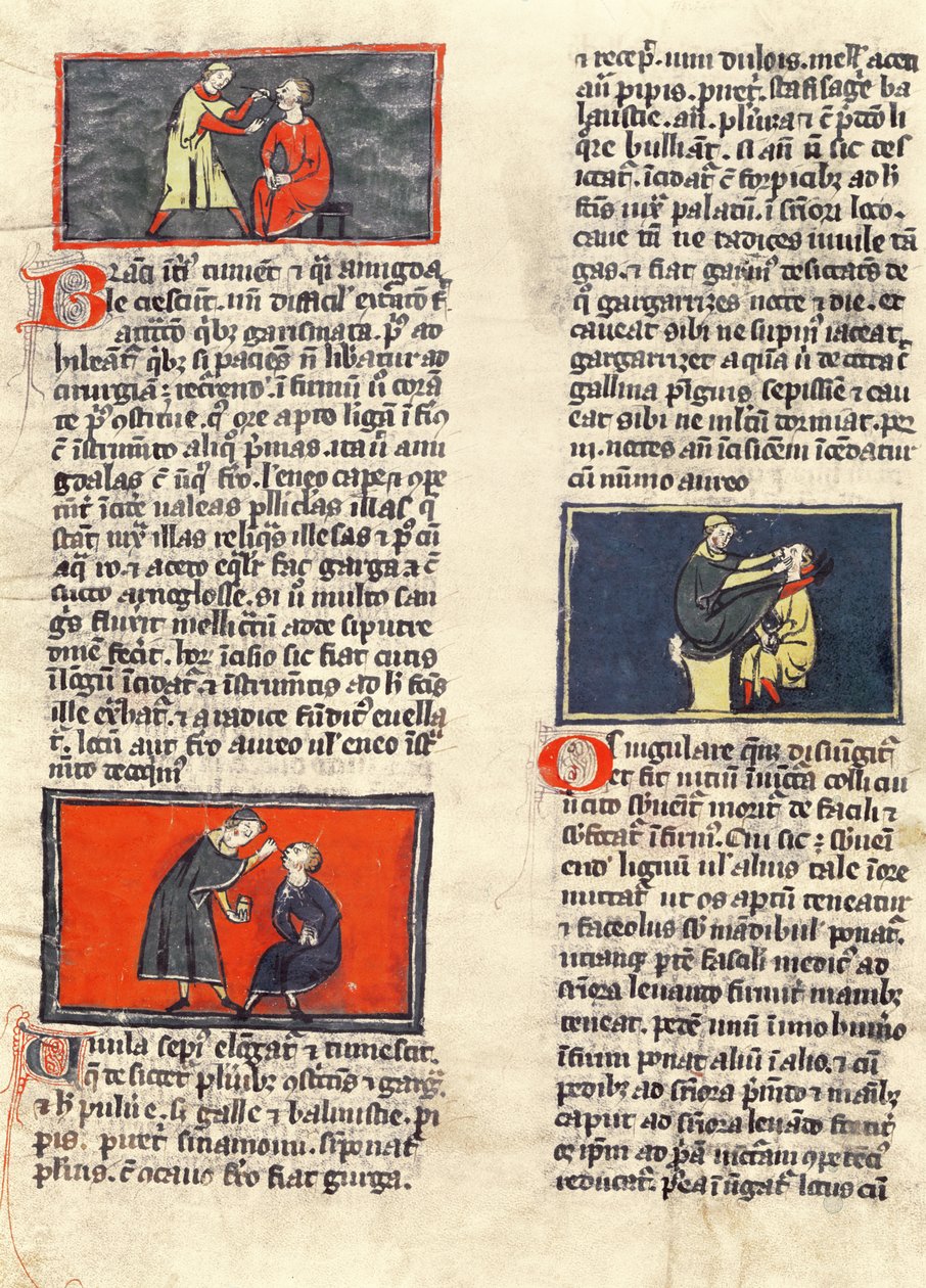 Ms H 89 fol.16v डेंटल सर्जरी, रोजर डी सालर्न द्वारा &39;बुक ऑफ सर्जरी&39; के एक संस्करण से द्वारा फ्रेंच स्कूल