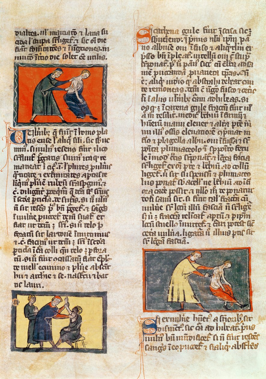 Ms H 89 fol.17r सर्जरी, रोजर डी सालर्न द्वारा &39;बुक ऑफ सर्जरी&39; के एक संस्करण से द्वारा फ्रेंच स्कूल