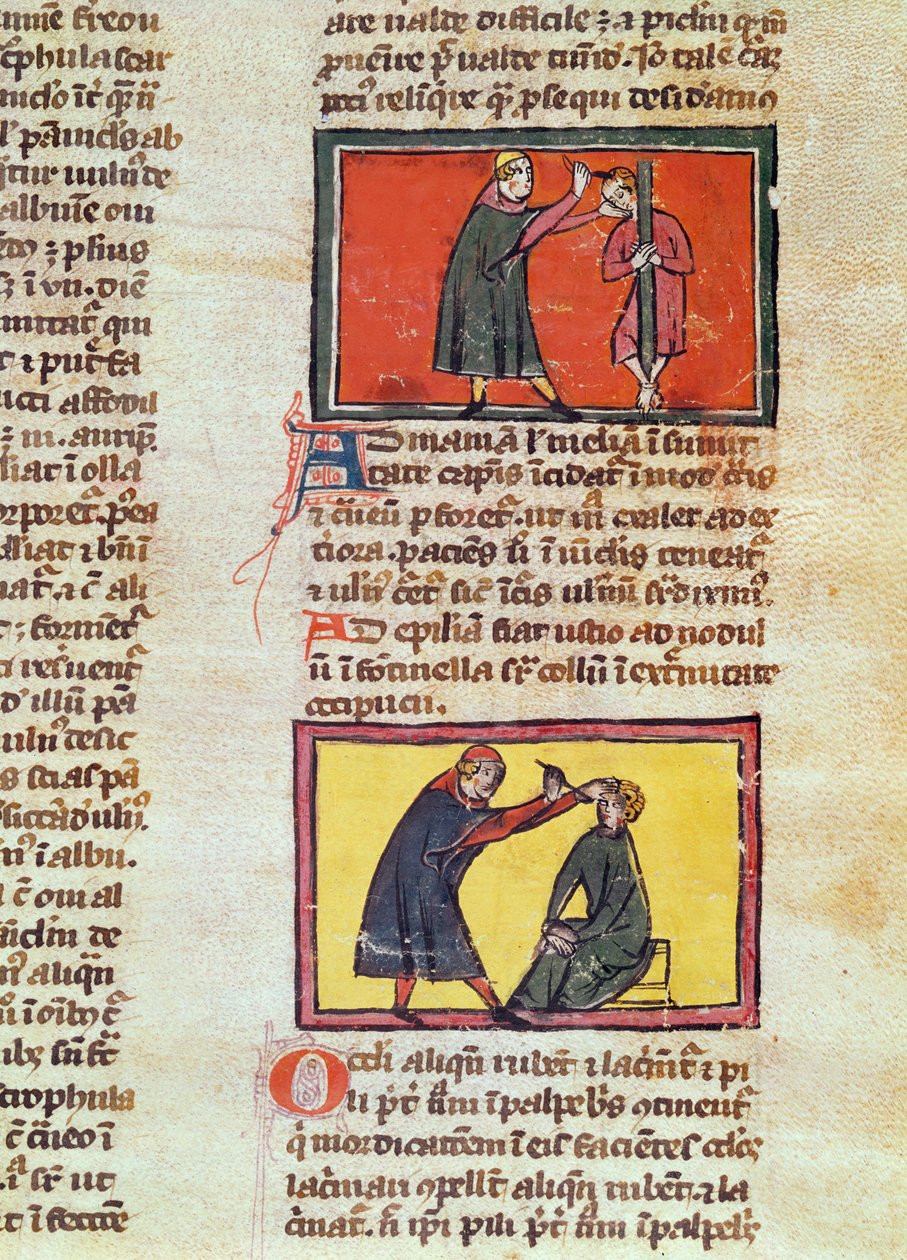 Ms H 89 fol.6 सर्जरी, रोजर डी सालर्न द्वारा &39;बुक ऑफ सर्जरी&39; के एक संस्करण से द्वारा फ्रेंच स्कूल