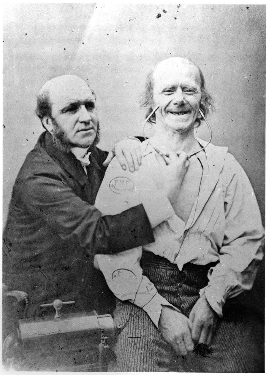 ड्यूकेन डे बाउलोगन द्वारा ललाट पेशी का फैराडाइजेशन, &39;मैकेनिज्म ऑफ ह्यूमन फिजियोग्निओमी या इलेक्ट्रोफिजियोलॉजिकल विश्लेषण&39; द्वारा गुइलूम बेंजामिन आर्मंड डुचेन डे बोग्लने