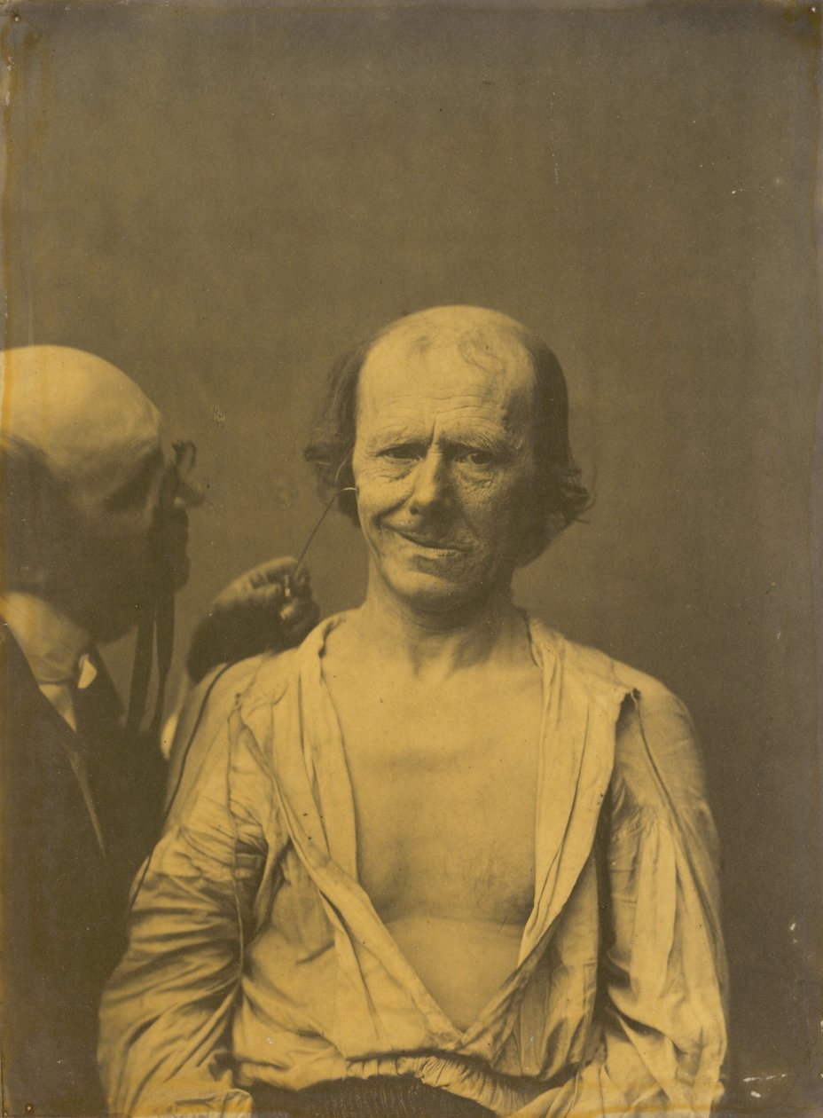 एक सुकून भरा चेहरा (बाएं); झूठी ख़ुशी या हँसी (दाएँ) द्वारा गिलौम बेंजामिन अमंत ड्यूचेन