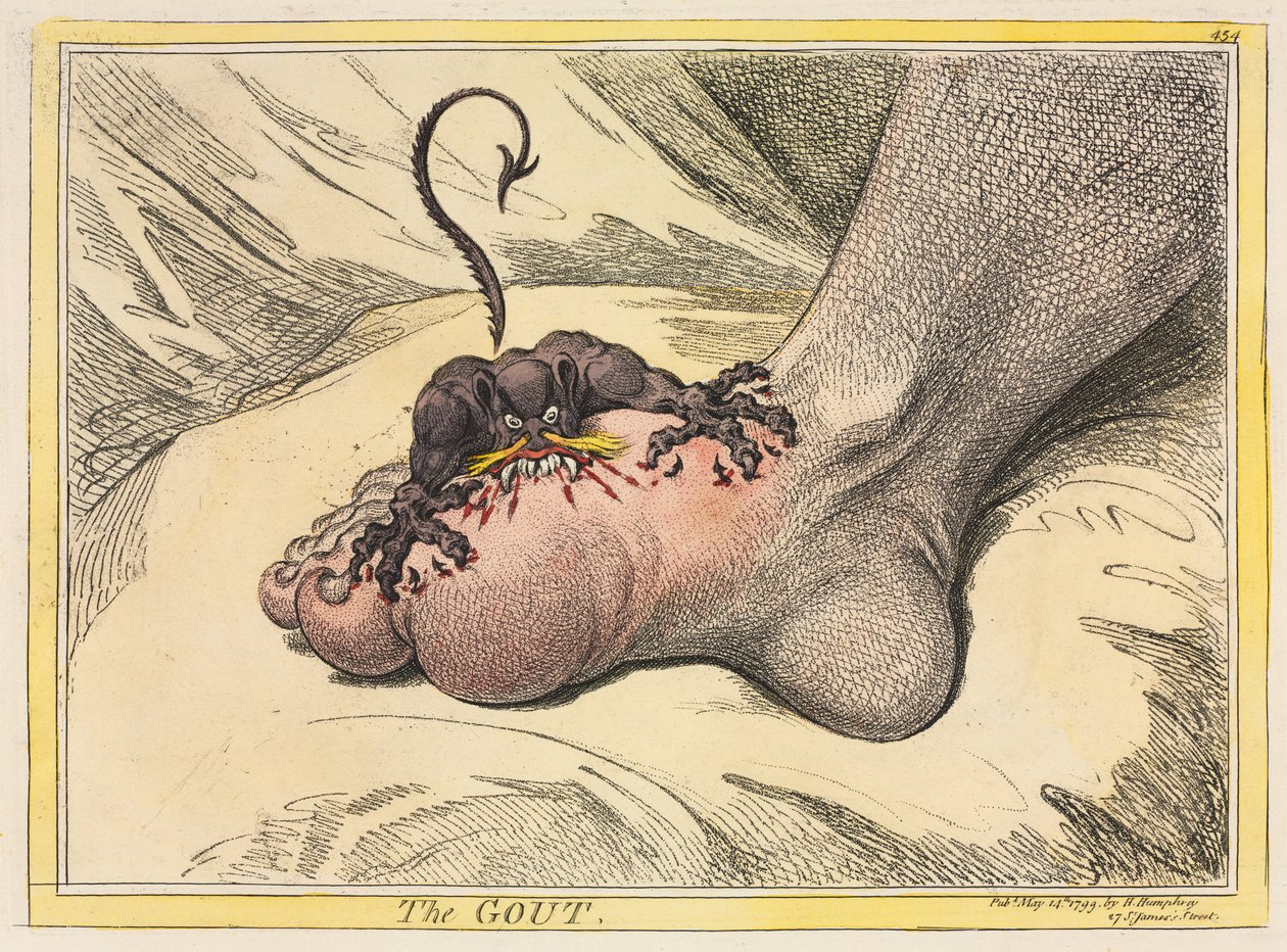 गाउट, 1799। द्वारा जेम्स गिलियरे