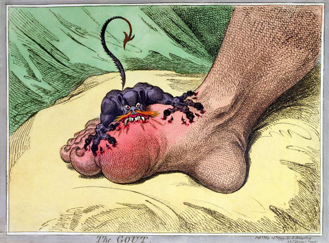 द गाउट, 1799 में हन्ना हम्फ़्रे द्वारा प्रकाशित (हाथ से रंगा हुआ सॉफ़्डग्राउंड नक़्क़ाशी) द्वारा जेम्स गिलियरे