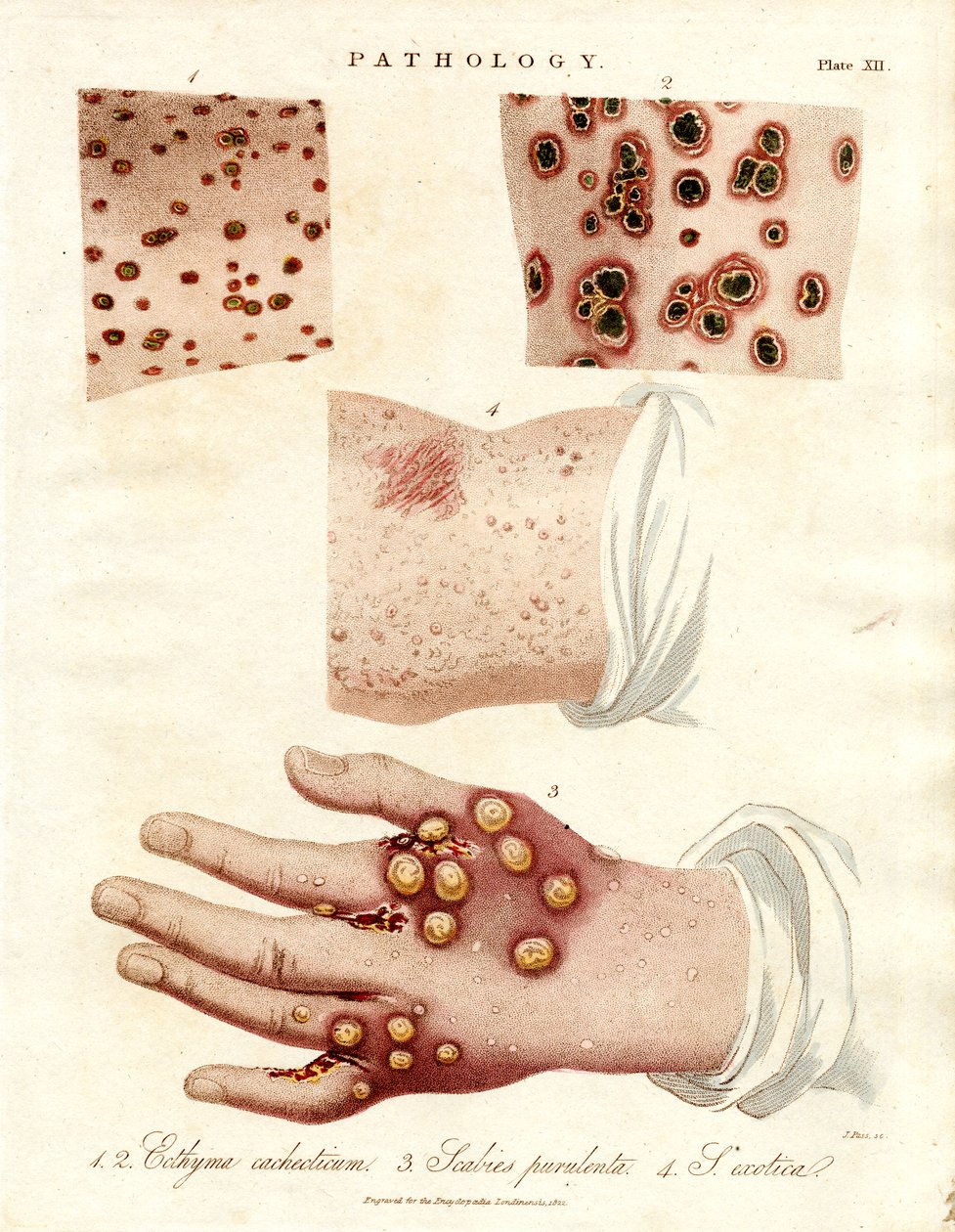  द्वारा जॉन पास