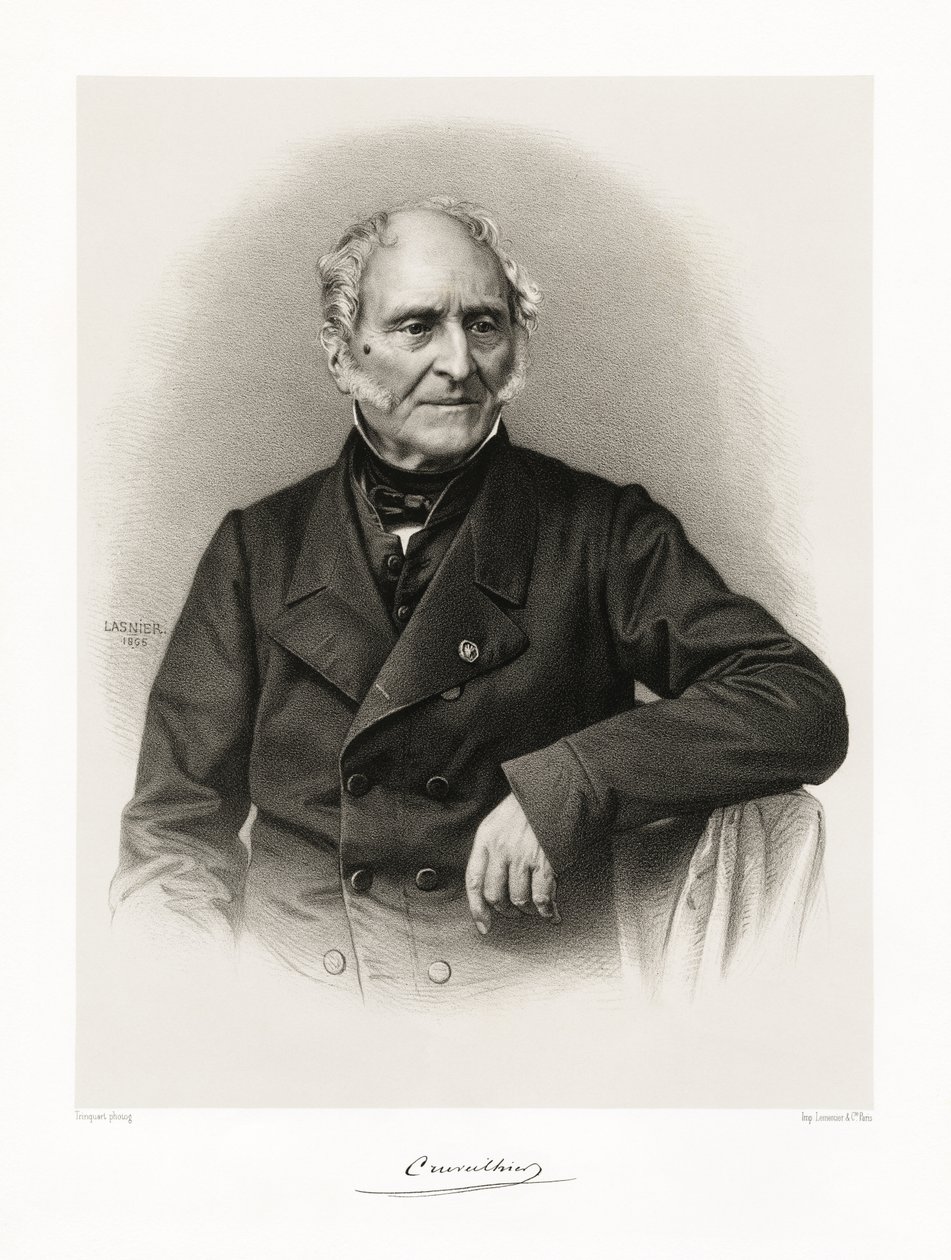 जीन क्रूविलियर, 1865-66 द्वारा Lasnier