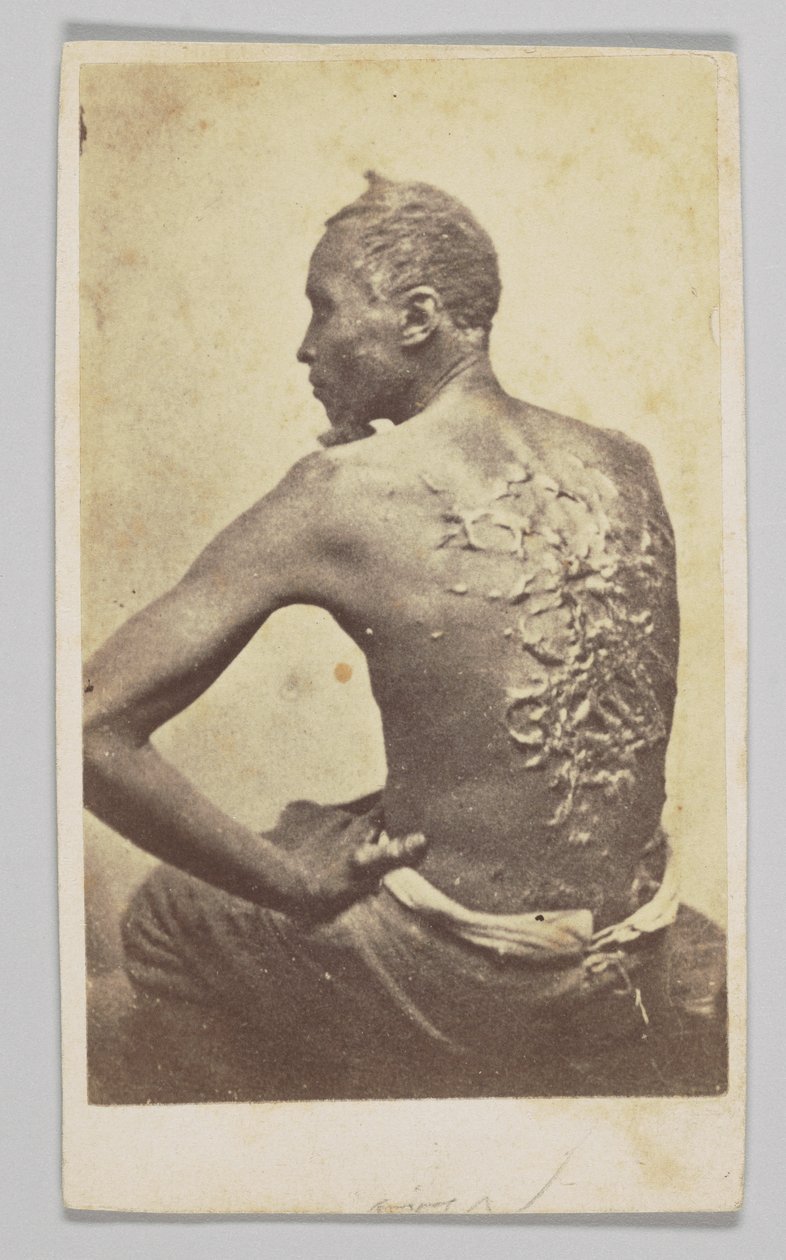 चिकित्सा निरीक्षण के तहत गॉर्डन, 1863। द्वारा मैकफर्सन और ओलिवर