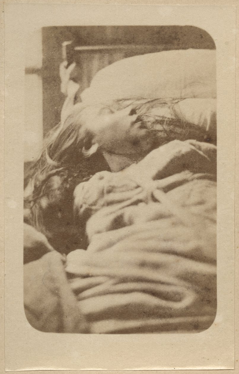 हिस्टीरिया का हमला, प्रथम चरण, बॉर्नविले एट पी। रेग्नार्ड, प्लेट II, पेरिस, 1876 (एल्बम प्रिंट) द्वारा &39;आइकोनोग्राफी फ़ोटोग्राफ़ी डी ला सालपेट्रीयर&39; से चित्र द्वारा पॉल रिगार्ड