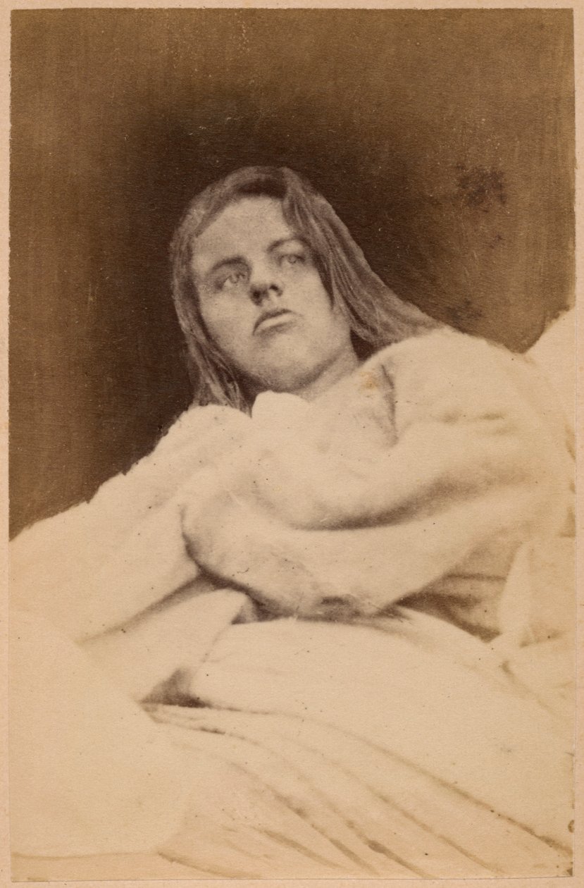 बोर्नविले और पी। रेग्नार्ड, पेरिस, 1876 (एल्बम प्रिंट) द्वारा हिस्टेरिकल मिर्गी, मतिभ्रम, तिरस्कार, प्लेट XXXI &39;ला सल्पीरीयर की फ़ोटोग्राफ़िक आइकनोग्राफी&39; द्वारा पॉल रिगार्ड