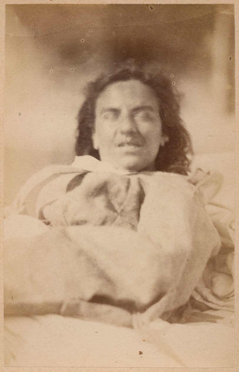 बोर्नविले और पी। रेग्नर्ड, पेरिस, 1876 (एल्बम प्रिंट) द्वारा हिस्टेरिकल मिर्गी, मतिभ्रम, विडंबना, प्लेट XXXII &39;ला सल्पीरीयर की फोटोग्राफिक आइकनोग्राफी&39; से द्वारा पॉल रिगार्ड