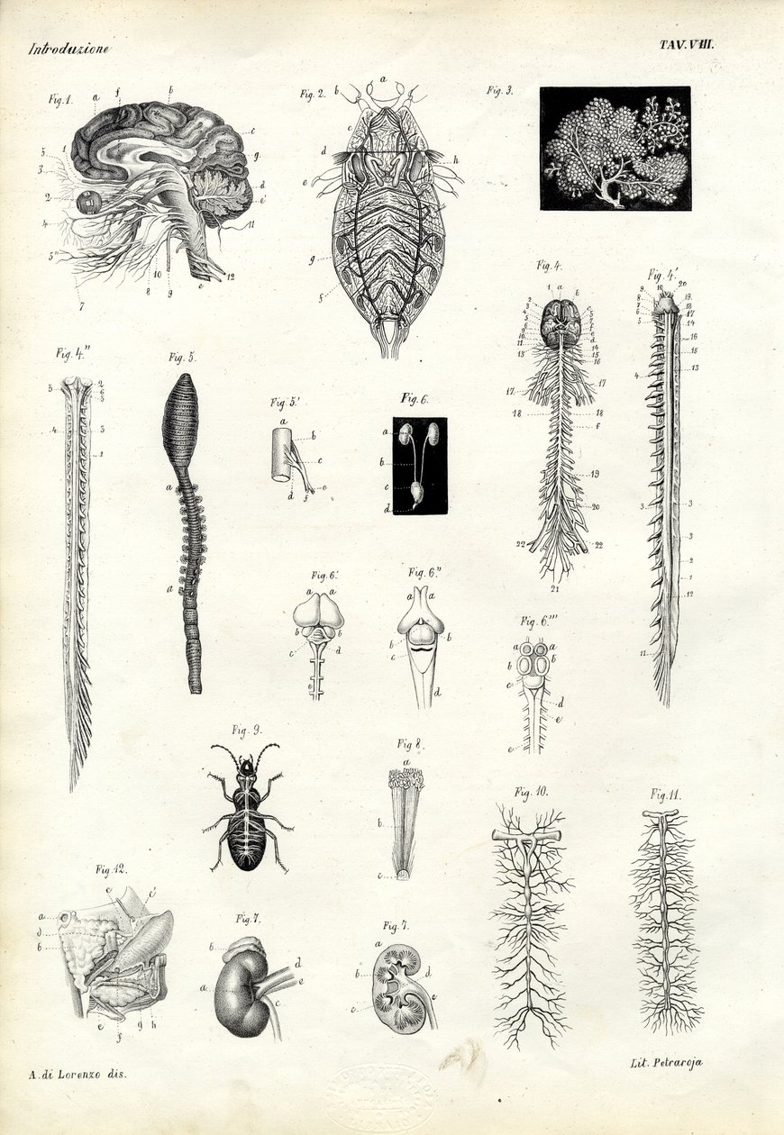 बैकबोन, 1863-79 द्वारा रायमुंडो पेट्रारोइया