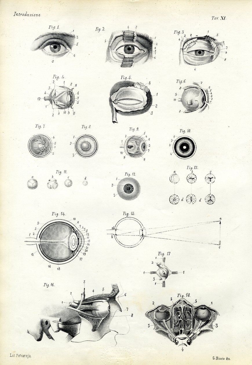 देखने का अंग, 1863-79 द्वारा रायमुंडो पेट्रारोइया
