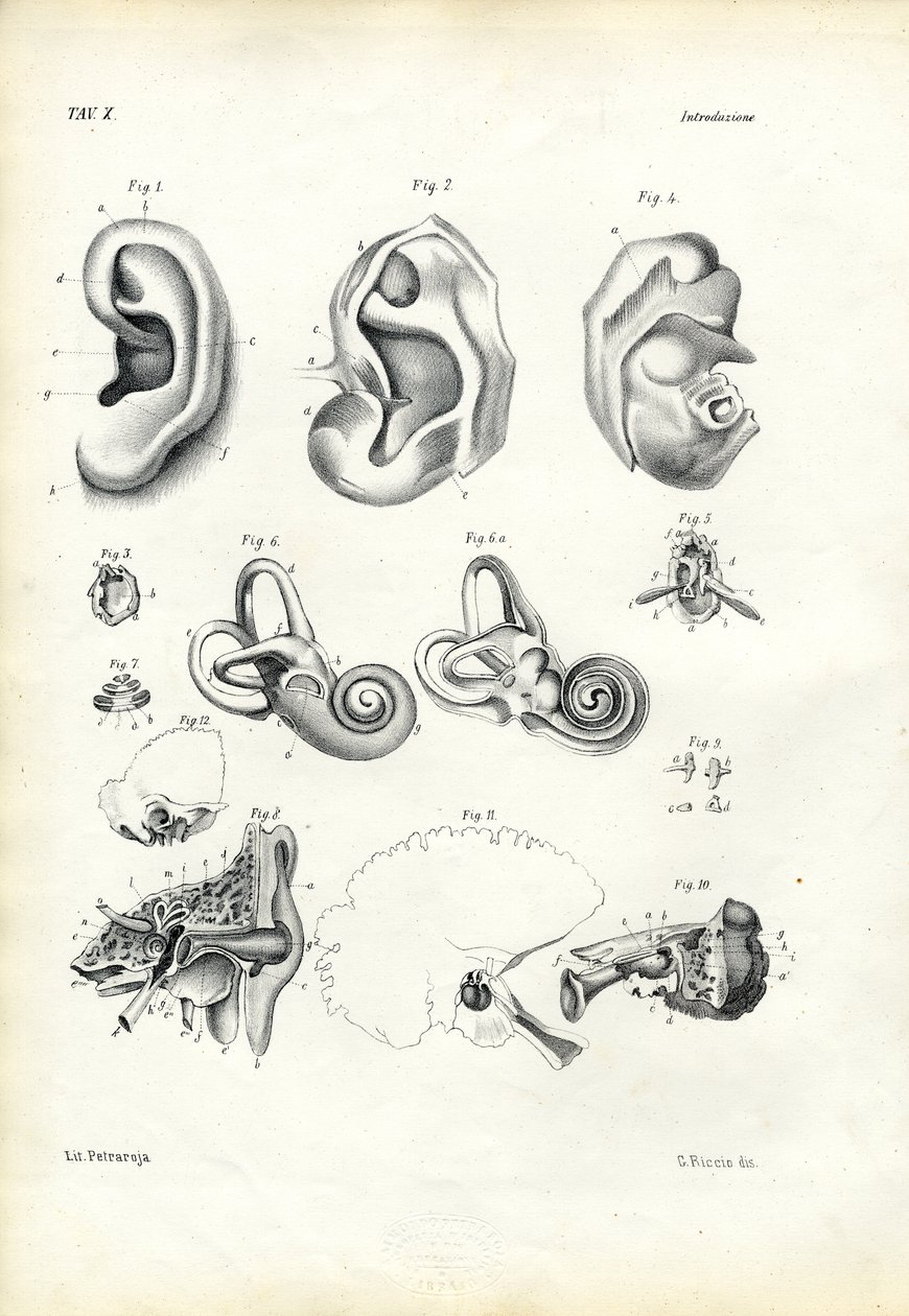 सुनवाई का अंग, 1863-79 द्वारा रायमुंडो पेट्रारोइया