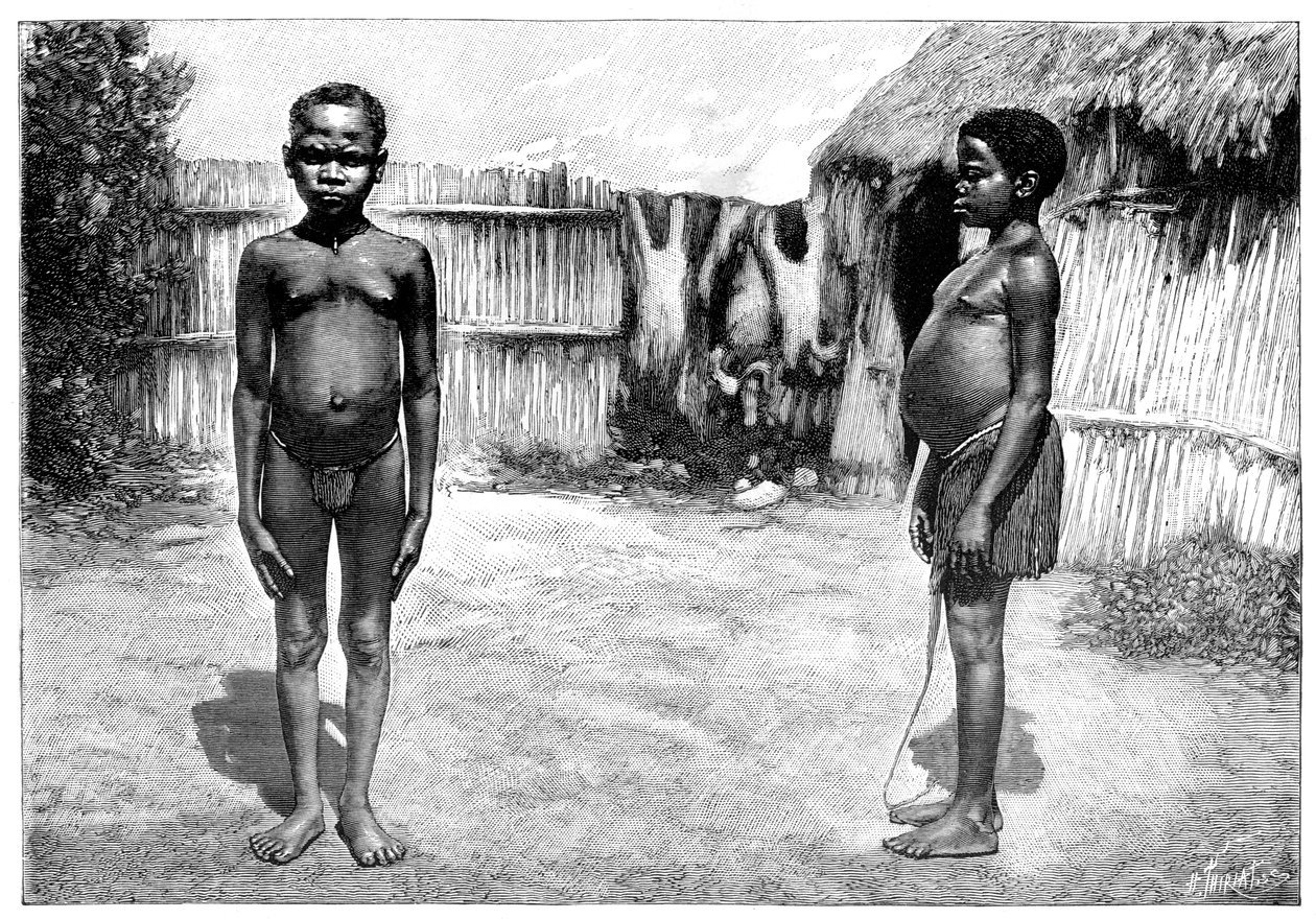 अक्का मैन एंड वुमन, c1880 द्वारा अज्ञात