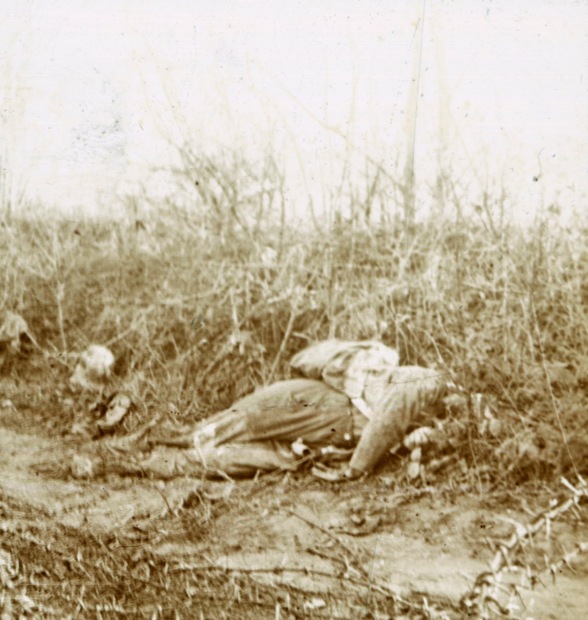 मृत सैनिक का शव, चेत्से-पोरिएन, उत्तरी फ्रांस, c1914-c1918 द्वारा अज्ञात