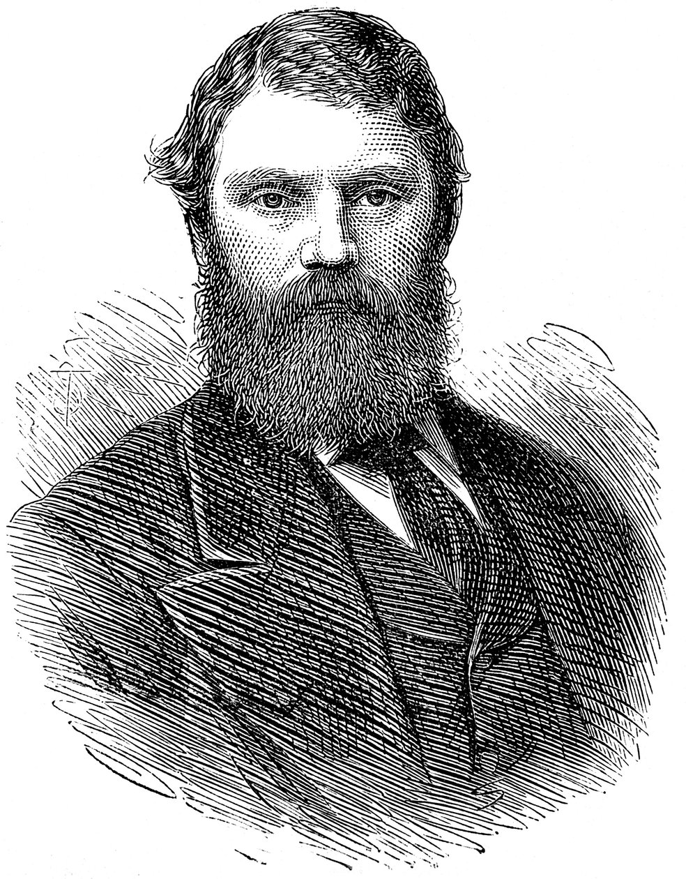 फ्रांसिस एडमंड एन्स्टी 1833-1874, अंग्रेजी चिकित्सक, 1874 द्वारा अज्ञात