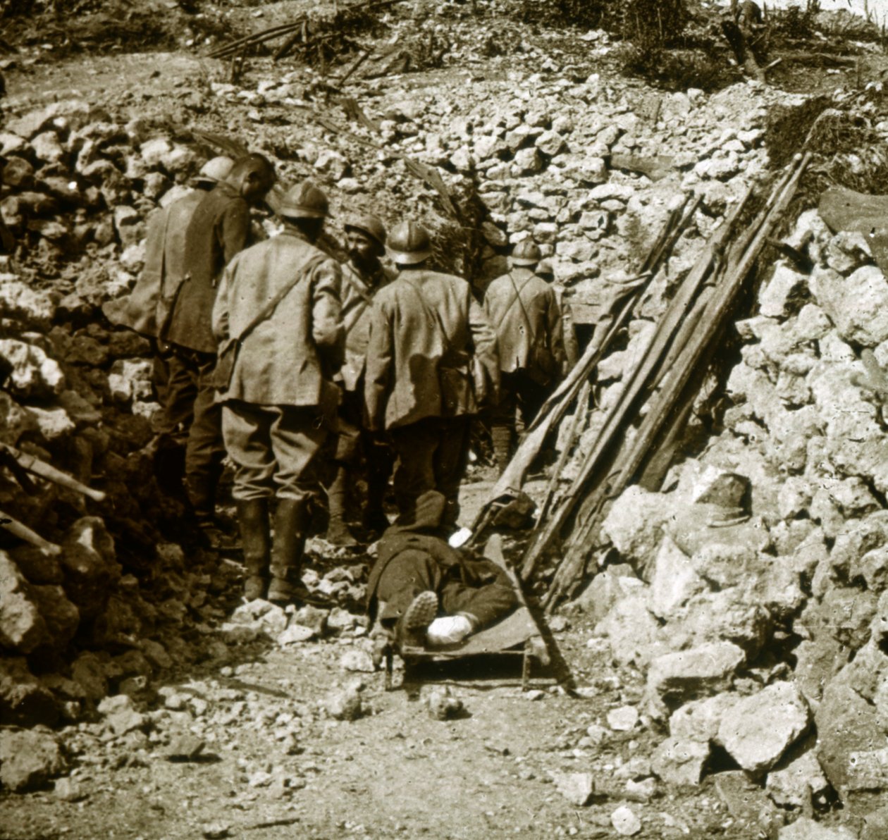 जर्मन घायल, c1914-c1918 द्वारा अज्ञात
