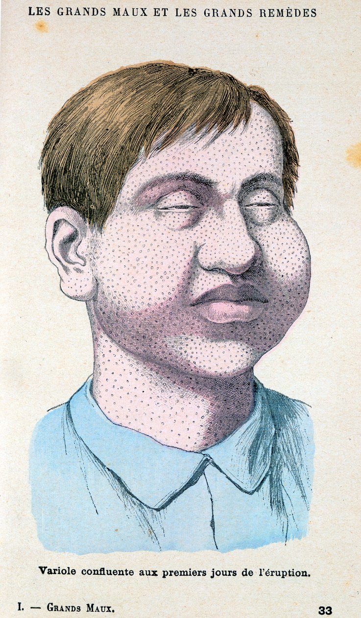चेचक का शिकार, c1890 द्वारा अज्ञात