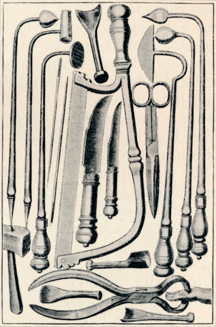 सर्जिकल उपकरण, 1639, 1903 द्वारा अज्ञात
