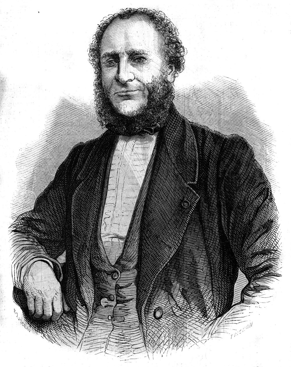 डॉक्टर जोबर्ट डी लैम्बले (1799-1867) फ्रांसीसी सर्जन का पोर्ट्रेट। "" ल 'विश्वविद्यालयों के शानदार" में उत्कीर्णन द्वारा अज्ञात कलाकार