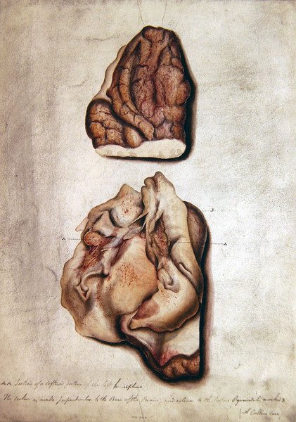 मस्तिष्क III का अध्ययन, c.1850 (कागज पर जल रंग) द्वारा विलियम प्रेमी