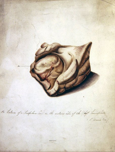 मस्तिष्क II का अध्ययन, c.1850 (कागज पर जल रंग) द्वारा विलियम प्रेमी