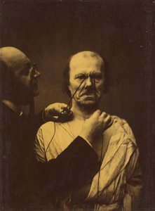 आक्रामकता, दुष्टता, 1854-1856, 1862 छपी। द्वारा डचेन डी बोलोग्ने