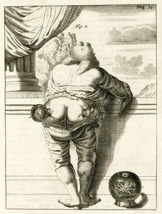 सिंघी, व्यावहारिक अभ्यास से का एक उदाहरण फ्रेडेरिक डेक्कर्स द्वारा, 1694 विधि के इलाज के लिए द्वारा डच स्कूल