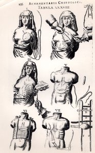 स्तन कैंसर पर संचालन, जोहानस शुल्टेस (1595-1645) द्वारा आर्मामेंटरी चिरुर्गिकी से, एम्स्टर्डम में 1672 में प्रकाशित द्वारा डच स्कूल