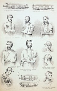 अस्थाई उपचार अस्थाई उपचार, c.1890 द्वारा अंग्रेजी स्कूल