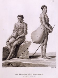 उत्तरी मारियाना द्वीप समूह: बुर्जुआ द्वारा उत्कीर्ण, &39;यूरेनिया 1817-20 के कोरवेट पर दुनिया भर की यात्रा&39; से तपेदिक से पीड़ित दो पुरुष, 1825 प्रकाशित