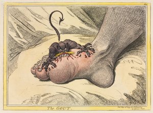 गाउट, 1799। द्वारा जेम्स गिलियरे
