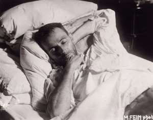 एगॉन शिएले अपनी मृत्युशय्या पर, 1918। द्वारा मार्था फीन