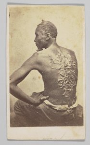 चिकित्सा निरीक्षण के तहत गॉर्डन, 1863। द्वारा मैकफर्सन और ओलिवर
