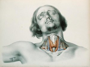 गले का क्रॉस-सेक्शन, 'एनोमलीज़ आर्टरीएल्स' से द्वारा जीन-बैप्टिस्ट-लियोन दुब्रेइल