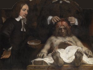 डॉ। जे डेमैन का एनाटॉमी लेसन, 1656 द्वारा रिमब्रांड वैन रिजन