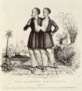 सियामी ब्रदर्स, एजेड 18, चार्ल्स हुलमंडेल (1789-1850) द्वारा मुद्रित, c.1829