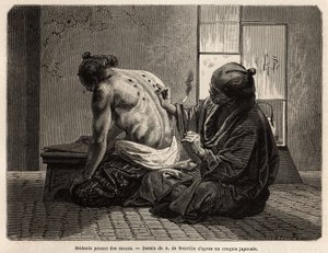 मोक्सास (शरीर के विशिष्ट भागों में जले हुए छोटे सेजब्रश शंकु), अपच से लेकर भूख न लगना, रोना और दांत दर्द के विभिन्न लक्षणों के खिलाफ एक निवारक उपचार, वर्ष में दो बार कार्यरत है और जापानियों द्वारा निर्धारित समय है। एंग्रेवी द्वारा अज्ञात कलाकार