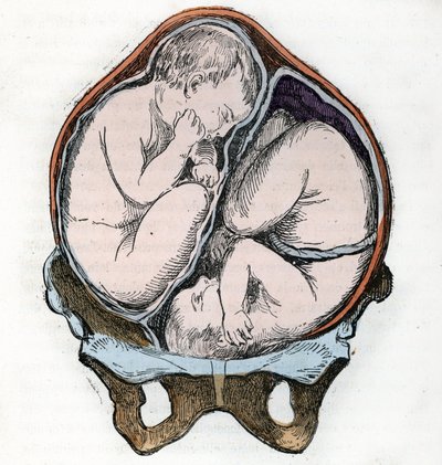  द्वारा A. डेमरले