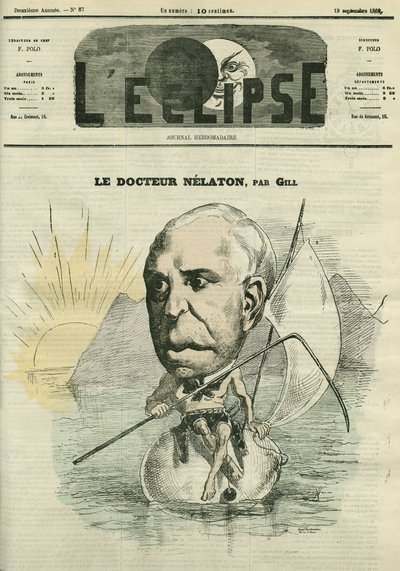 अगस्टे नेलाटन (1807-1873), फ्रांसीसी सर्जन। गिल द्वारा "" L'Eclipse" में कवर, सितम्बर १९ द्वारा एंड्रयू गिल