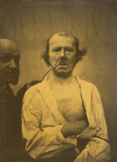 एक आराम से अभिव्यक्ति बाएं, घृणा दाएं, 1854-1856, 1862 मुद्रित। द्वारा डचेन डी बोलोग्ने