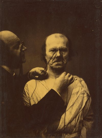 आक्रामकता, दुष्टता, 1854-1856, 1862 छपी। द्वारा डचेन डी बोलोग्ने