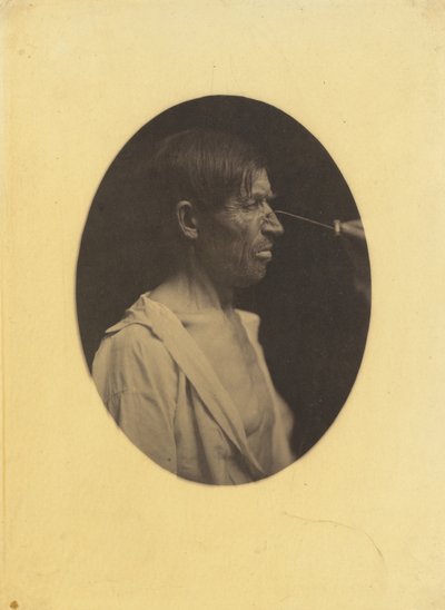 बुरा हास्य, असंतोष, 1854-1856, 1862 मुद्रित। द्वारा डचेन डी बोलोग्ने
