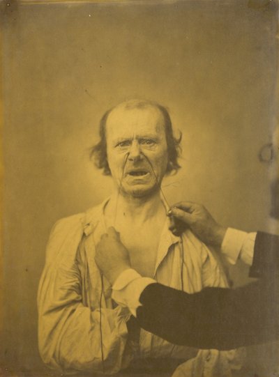असंतोष, बुरा हास्य, 1854-1856, 1862 मुद्रित। द्वारा डचेन डी बोलोग्ने